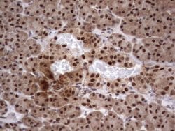 C14orf166 Monoclonal Antibody (OTI2D2), TrueMAB , OriGene 30 &mu;L; Unconjugated:Antibodies,