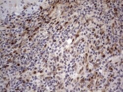 C14orf166 Monoclonal Antibody (OTI2D2), TrueMAB , OriGene 30 &mu;L; Unconjugated:Antibodies,