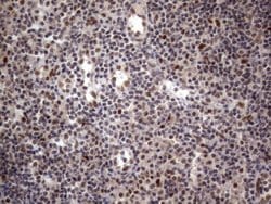 C14orf166 Monoclonal Antibody (OTI2D2), TrueMAB , OriGene 30 &mu;L; Unconjugated:Antibodies,