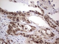 C14orf166 Monoclonal Antibody (OTI2D2), TrueMAB , OriGene 30 &mu;L; Unconjugated:Antibodies,