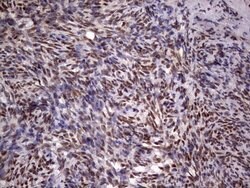 C14orf166 Mouse anti-Human, Clone: OTI1E5, TrueMAB , Origene 30 &mu;L;