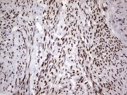 C14orf166 Mouse anti-Human, Clone: OTI1E5, lyophilized, TrueMAB 100 &mu;g;