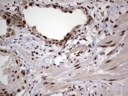 C14orf166 Mouse anti-Human, Clone: OTI1E5, lyophilized, TrueMAB 100 &mu;g;