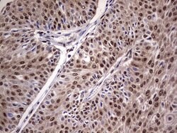 C14orf166 Mouse anti-Human, Clone: OTI1E5, lyophilized, TrueMAB 100 &mu;g;