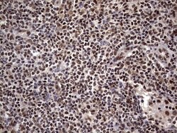C14orf166 Mouse anti-Human, Clone: OTI1E5, lyophilized, TrueMAB 100 &mu;g;