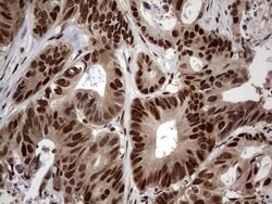 C14orf166 Mouse anti-Human, Clone: OTI1E5, lyophilized, TrueMAB 100 &mu;g;