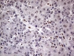 C14orf166 Mouse anti-Human, Clone: OTI1E5, lyophilized, TrueMAB 100 &mu;g;