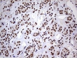 C14orf166 Monoclonal Antibody (OTI1G8), TrueMAB , OriGene 100 &mu;L; Unconjugated:Antibodies,