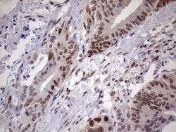 C14orf166 Monoclonal Antibody (OTI1G8), TrueMAB , OriGene 100 &mu;L; Unconjugated:Antibodies,