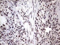 C14orf166 Monoclonal Antibody (OTI1G8), TrueMAB , OriGene:Antibodies:Primary