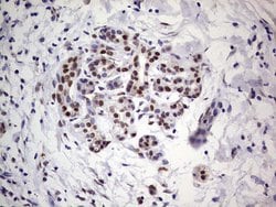 C14orf166 Monoclonal Antibody (OTI4A3), TrueMAB , OriGene 100 &mu;L; Unconjugated:Antibodies,