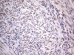 C14orf166 Mouse anti-Human, Clone: OTI4A3, lyophilized, TrueMAB 100 &mu;g;