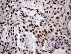 C14orf166 Monoclonal Antibody (OTI1B2), TrueMAB , OriGene 100 &mu;L; Unconjugated:Antibodies,