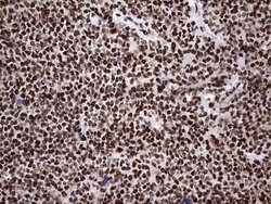 C14orf166 Monoclonal Antibody (OTI1B2), TrueMAB , OriGene 100 &mu;L; Unconjugated:Antibodies,