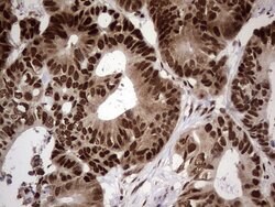 C14orf166 Monoclonal Antibody (OTI1B2), TrueMAB , OriGene 100 &mu;L; Unconjugated:Antibodies,