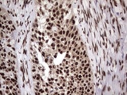 C14orf166 Monoclonal Antibody (OTI1B2), TrueMAB , OriGene 100 &mu;L; Unconjugated:Antibodies,
