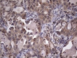 C14orf166 Monoclonal Antibody (OTI2C3), TrueMAB , OriGene:Antibodies:Primary