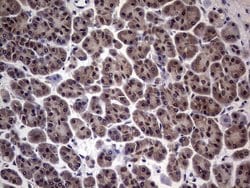 C14orf166 Monoclonal Antibody (OTI2C3), TrueMAB , OriGene 100 &mu;L; Unconjugated:Antibodies,