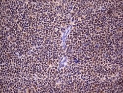 C14orf166 Monoclonal Antibody (OTI2C3), TrueMAB , OriGene 100 &mu;L; Unconjugated:Antibodies,