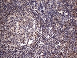 C14orf166 Monoclonal Antibody (OTI2C3), TrueMAB , OriGene 100 &mu;L; Unconjugated:Antibodies,