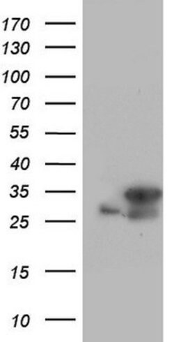 C14orf166 Mouse anti-Human, Clone: OTI1E5, lyophilized, TrueMAB 100 &mu;g;