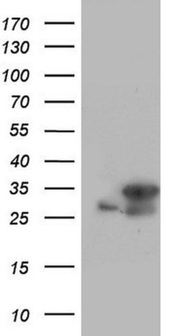 C14orf166 Mouse anti-Human, Clone: OTI1E5, TrueMAB , Origene 30 &mu;L;