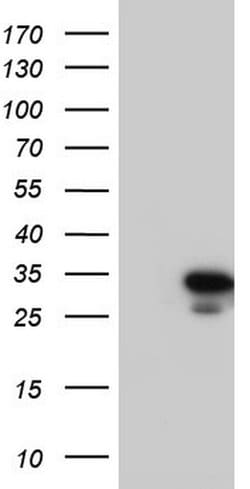 C14orf166 Monoclonal Antibody (OTI1G8), TrueMAB , OriGene:Antibodies:Primary