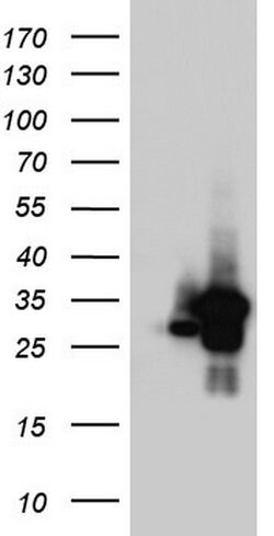 C14orf166 Monoclonal Antibody (OTI2D6), TrueMAB , OriGene:Antibodies:Primary