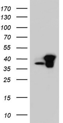 C14orf166 Monoclonal Antibody (OTI1B2), TrueMAB , OriGene 100 &mu;L; Unconjugated:Antibodies,
