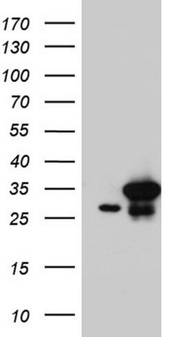 C14orf166 Monoclonal Antibody (OTI2C3), TrueMAB , OriGene:Antibodies:Primary