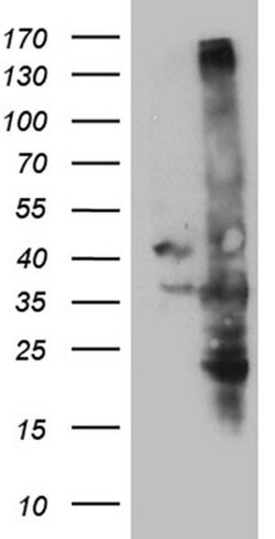 C16orf57 Monoclonal Antibody (OTI1B1), TrueMAB , OriGene 30 &mu;L; Unconjugated:Antibodies,
