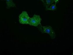 C16orf72 Monoclonal Antibody (OTI1A2), TrueMAB , OriGene 30 &mu;L; Unconjugated:Antibodies,