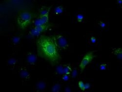 C17orf28 Mouse anti-Human, Clone: OTI4F6, lyophilized, TrueMAB 100 &mu;g;