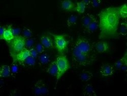C17orf28 Mouse anti-Human, Clone: OTI1B10, lyophilized, TrueMAB 100 &mu;g;