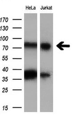 C17orf28 Monoclonal Antibody (OTI5C4), TrueMAB , OriGene 30 μL; Unconjugated:Antibodies,