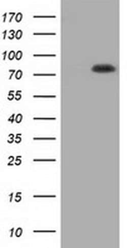 C17orf28 Monoclonal Antibody (OTI2E9), TrueMAB , OriGene 30 &mu;L; Unconjugated:Anticuerpos
