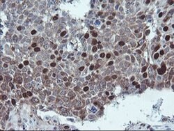 C17orf37 Monoclonal Antibody (OTI2D5), TrueMAB , OriGene 100 &mu;L; Unconjugated:Antibodies,