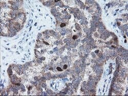 C17orf37 Monoclonal Antibody (OTI2D5), TrueMAB , OriGene 100 &mu;L; Unconjugated:Antibodies,