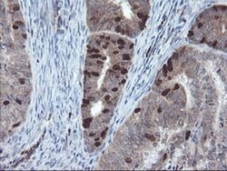 C17orf37 Monoclonal Antibody (OTI2D5), TrueMAB , OriGene 100 &mu;L; Unconjugated:Antibodies,