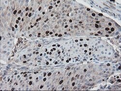 C17orf37 Monoclonal Antibody (OTI2D5), TrueMAB , OriGene 100 &mu;L; Unconjugated:Antibodies,