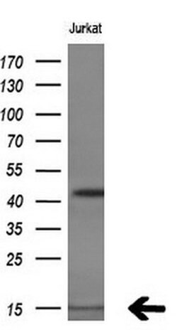 C17orf37 Monoclonal Antibody (OTI1D7), TrueMAB , OriGene 100 &mu;L | Buy Online | Origene Technologies | Fisher Scientific