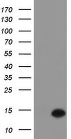 C17orf37 Monoclonal Antibody (OTI4D6), TrueMAB , OriGene:Antibodies:Primary