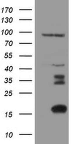 C17orf37 Monoclonal Antibody (OTI2D5), TrueMAB , OriGene 100 &mu;L; Unconjugated:Antibodies,