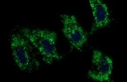 C17orf62 Mouse anti-Human, Clone: OTI3F10, lyophilized, TrueMAB 100 &mu;g;