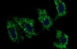 C17orf62 Monoclonal Antibody (OTI3F10), TrueMAB , OriGene 100 &mu;L; Unconjugated:Antibodies,