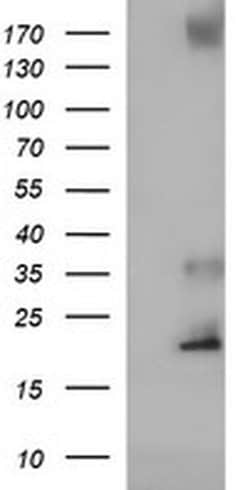 C17orf62 Monoclonal Antibody (OTI3B5), TrueMAB , OriGene 100 &mu;L; Unconjugated:Antibodies,