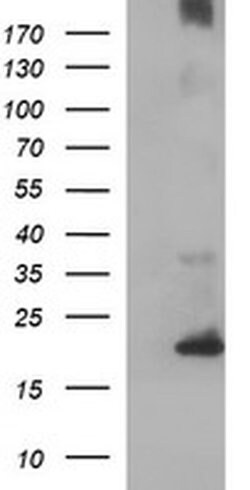 C17orf62 Monoclonal Antibody (OTI3E11), TrueMAB , OriGene 100 &mu;L; Unconjugated:Antibodies,
