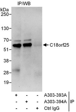 C18orf25 Rabbit anti-Human, Polyclonal, Bethyl Laboratories 10 &mu;l; Unlabeled:Antibodies,