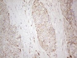 C19ORF80 Monoclonal Antibody (OTI1B12), TrueMAB , OriGene:Antibodies:Primary