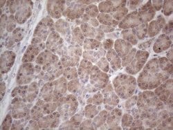 C19ORF80 Monoclonal Antibody (OTI4G8), TrueMAB , OriGene 100 &mu;L; Unconjugated:Antibodies,